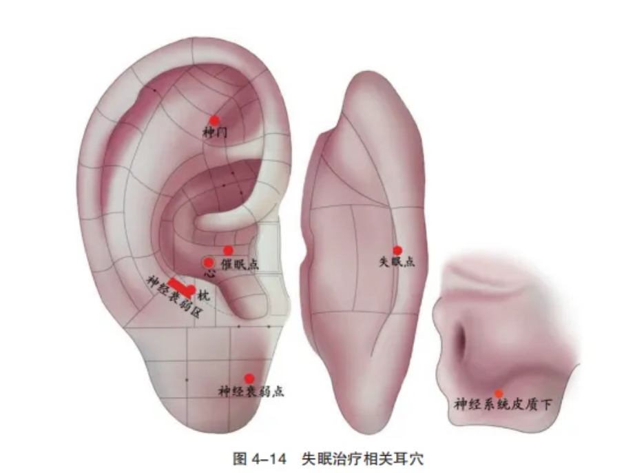 无锡养老院,无锡敬老院,无锡护理院,经开区养老院,无锡康复医院,术后康复,瘫痪护理,阿尔兹海默症,无锡养老院哪家好,无锡养老哪里好,无锡养老院前十排名